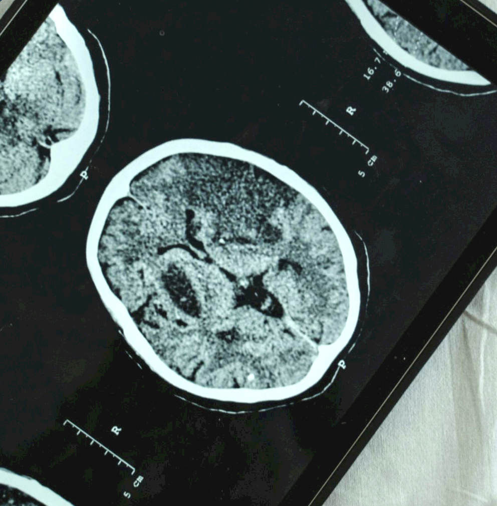 Silurus medical imaging